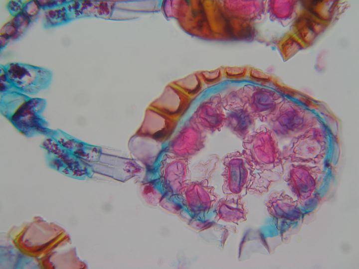 Polypodiales: esporangios CL de un esporangio anillo esporas