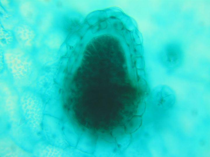 Embrión en helechos gametofito antigua pared del