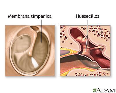Oído medio: El oído medio es un espacio lleno de aire, llamado cavidad timpánica, que está situado dentro del hueso temporal.