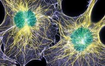 Citoesqueleto: Microfilamentos Las funciones de los microfilamentos son: - Los filamentos de actina y meiosina, junto con otras proteínas asociadas, están implicadas en diversos tipos de movimientos