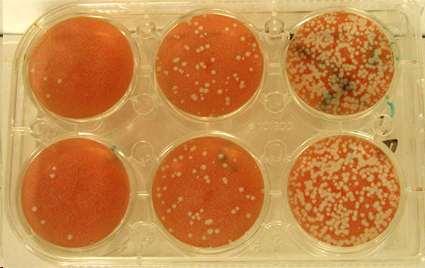 VIRUS: Efecto citopatico: Lisis celular Cuantificación según efecto