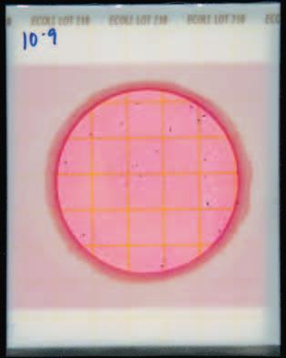 El círculo muestra una colonia rojo-azul cuyo recuento se hizo con luz de atrás. El círculo 2 muestra la misma colonia con luz de frente.