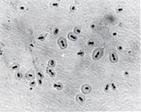 Esta tinción es para detectar al microorganismo entero, de manera que la morfología y las agrupaciones celulares resulten visibles.