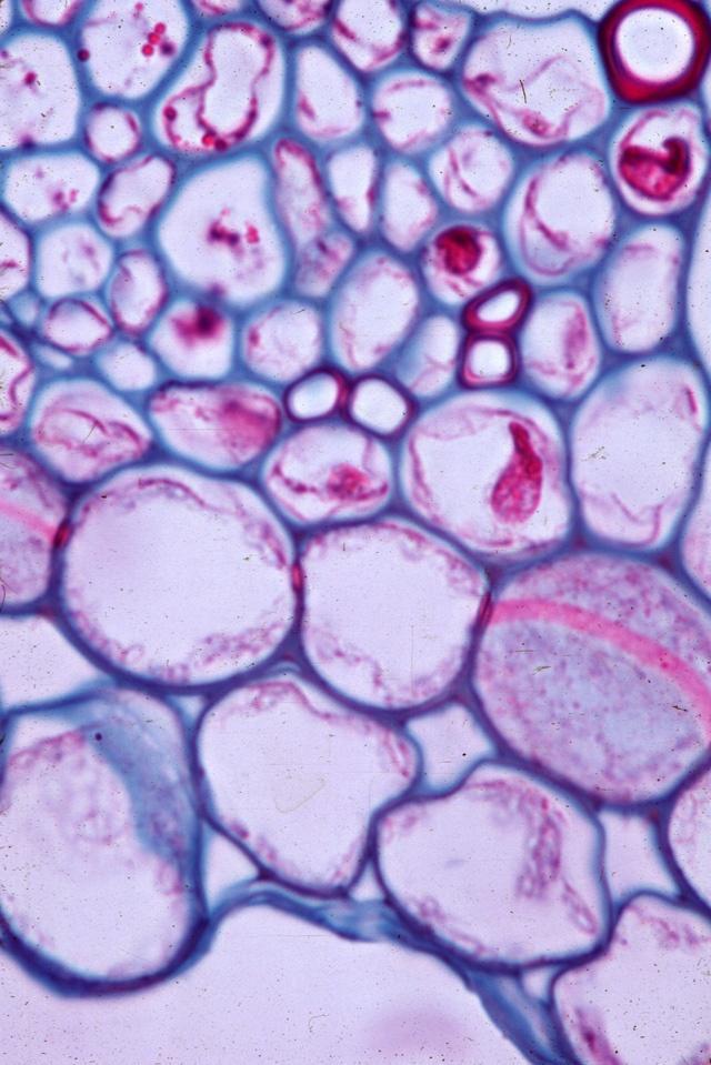 La endodermis: Banda de Caspary La endodermis es la capa de células más interna