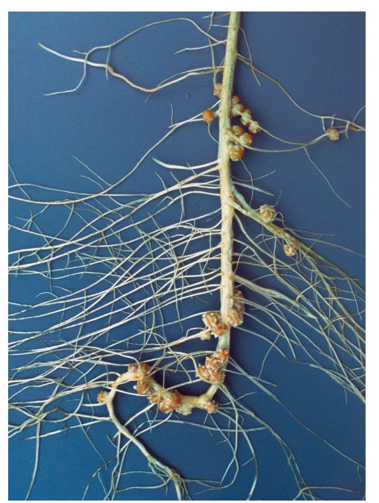 Asociaciones de las raíces con microorganismos del suelo nódulo Fijación simbiótica de nitrógeno Las plantas