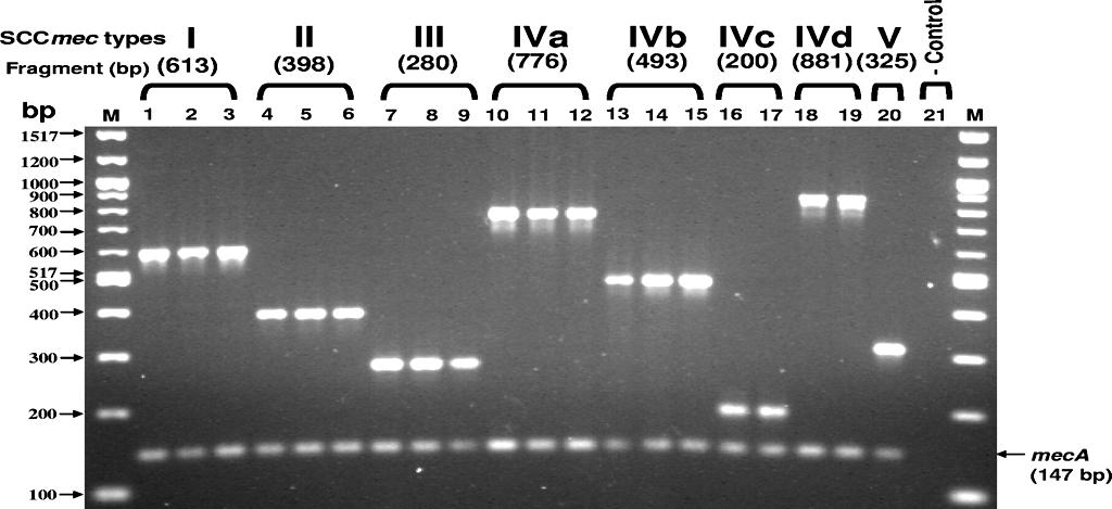 Detección y/o cuantificación de bacterias o genes: PCR convencional, anidada, múltiple, qpcr 3.