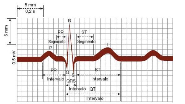Electrocardiogramas (derivación II) que muestran variaciones anómalas y normales de los ritmos