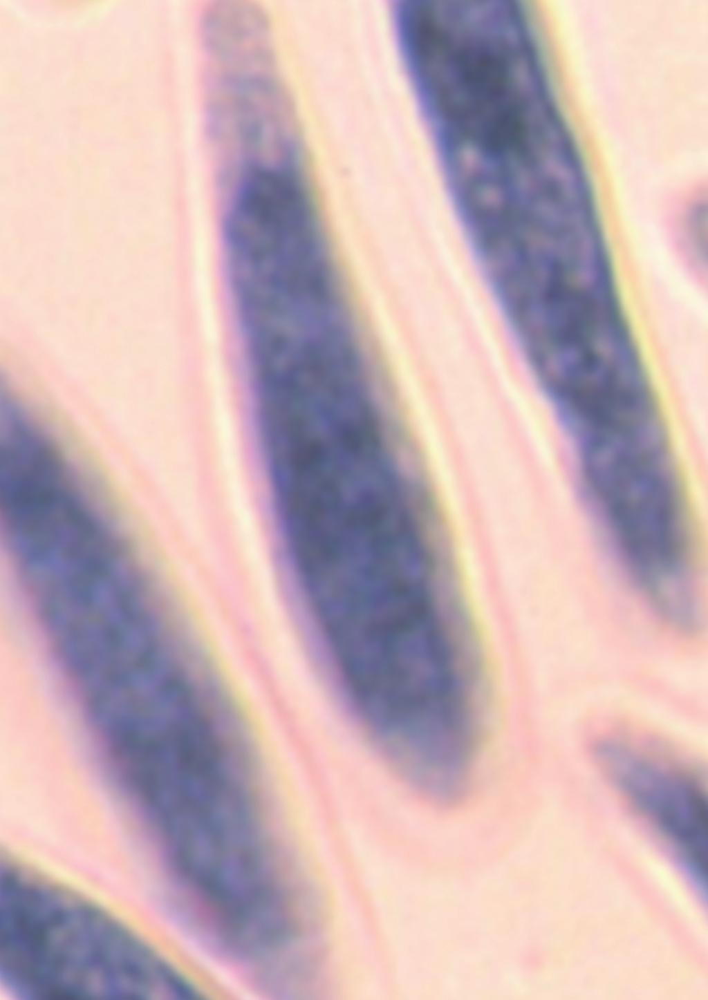 AGENTE CAUSAL Botryosphaeria dothidea (Mong.:Fr.) Ces. et de Not. (Anamorfo: Fusicoccum aesculi). ESPECIES SUSCEPTIBLES El complejo B. dothidea / B.