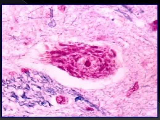 - El retículo endoplásmico rugoso se encuentra en subunidades dispersas en el citoplasma que se