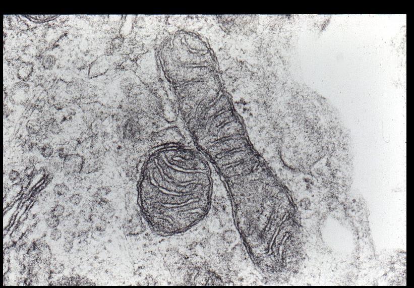 Resultados 1.- Mitocondria La micondriia es un orgánulo membranoso, formando por dos membrana una intera y la otra externa, aquí se realiza la respiración celular con obejtivo de producir energía.