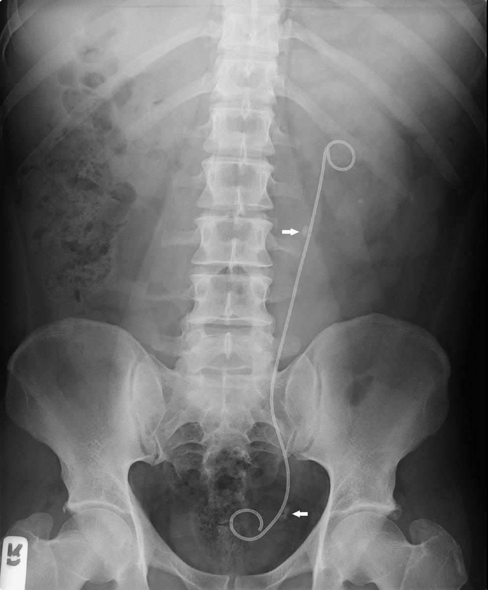 Fig. 12: Paciente 4. Radiografía simple.