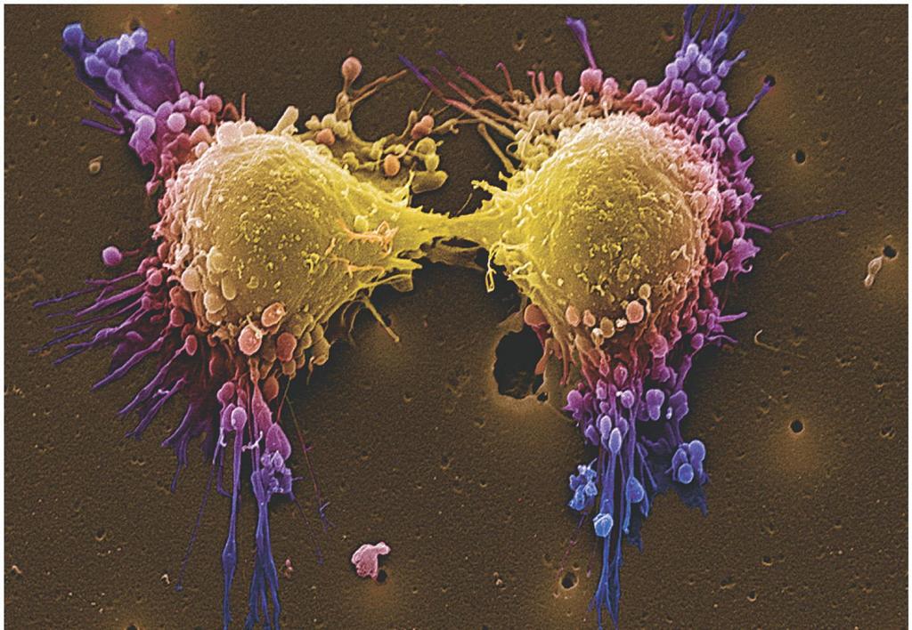 La Celula Cancerosa es una excepción f uera del control del Ciclo