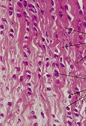 CARTILAGO FIBROSO Los condrocitos se diseminan entre los haces de fibras de colágeno