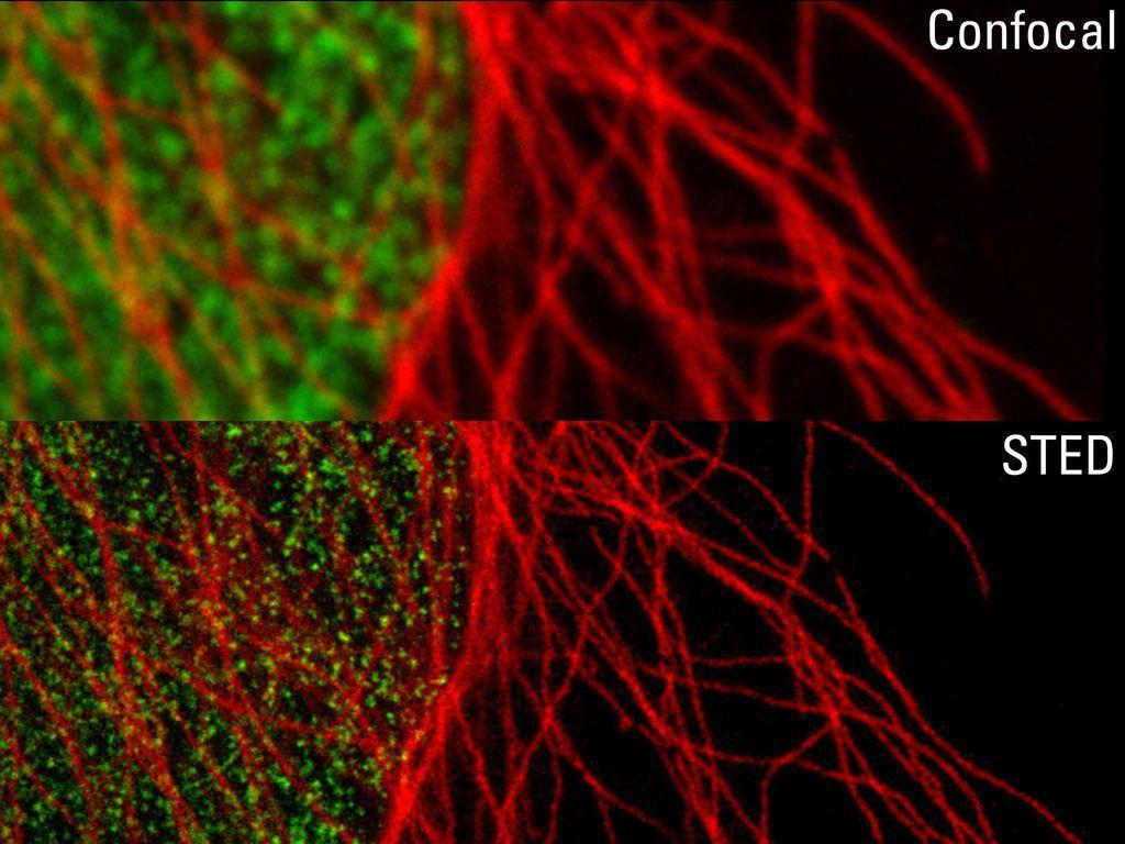 Confocal VS STED.