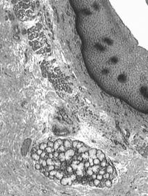 unicelulares mucosas Amniotas Epitelio plano ± cornificado Mucoso ciliado en tortugas acuáticas Glándulas pluricelulares mucosas: Cardiales