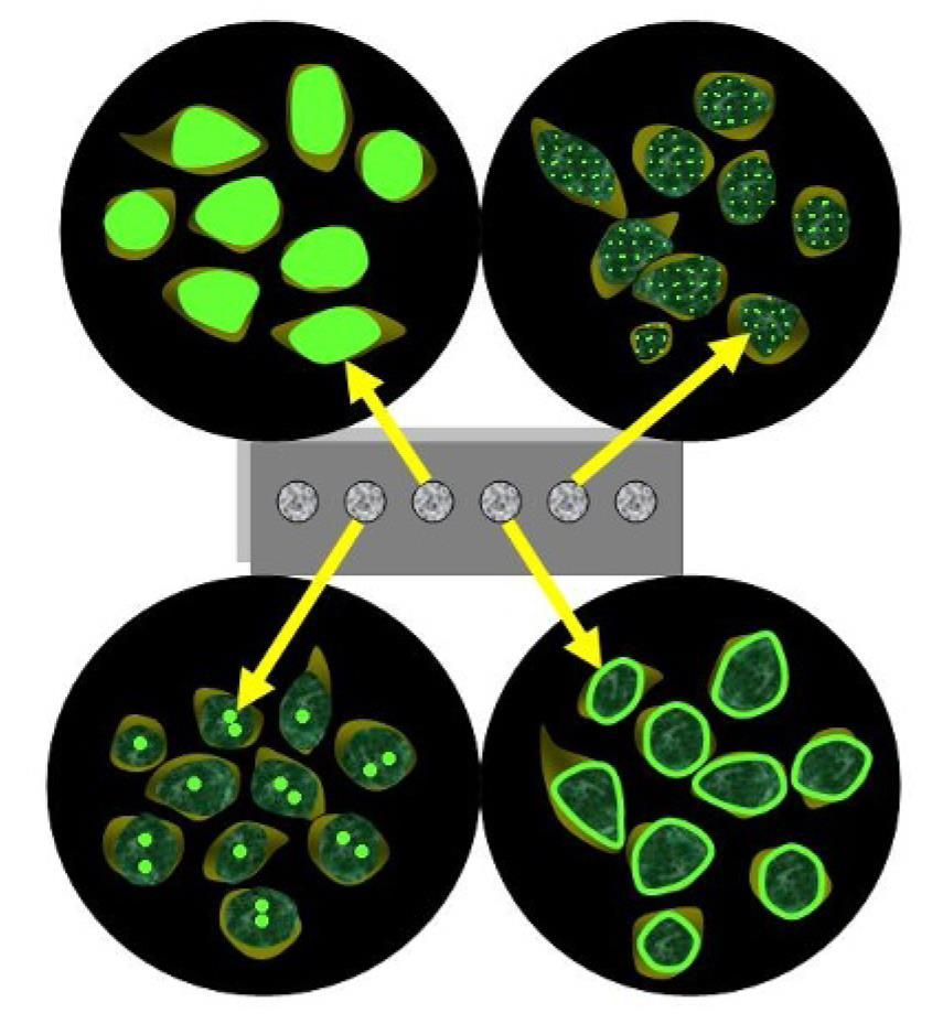 Inmunofluorescencia Anticuerpos Antinucleares ANA Patrones Asociados a Enfermedades Autoinmunes Patrón Homogéneo (ADN-dc, Histonas) Lupus Eritematoso Sistémico LES inducido por Drogas Patrón