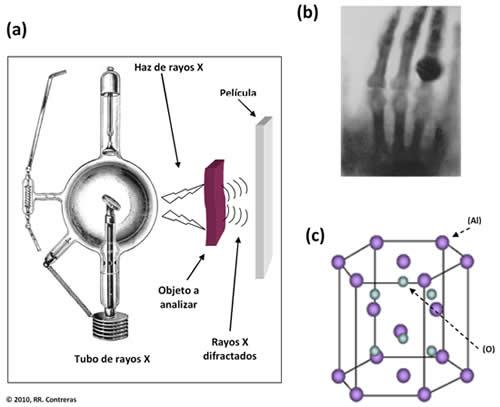 (a) Esquema del funcionamiento de la técnica de rayos X. (b) Radiografía de la mano de Anna Bertha Ludwig, esposa de Wilhelm Conrad Roentgen, descubridor de los rayos X.