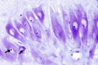 La célula. Núcleo. 12 El nucléolo es un compartimento nuclear formado por cromatina y visible al microscopio óptico. Las células de mamíferos contienen desde 1 a 5 nucléolos.