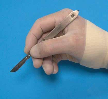 Las tijeras también pueden ser manejadas con una toma de eminencia tenar modificada, también llamada eminencia tenar-dedo anular (fig. 1-31).