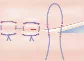 SUTURA DE ORGANOS ESPECIFICOS A continuación, se mencionan las principales características de las suturas de órganos huecos que se hacen con cierta frecuencia.