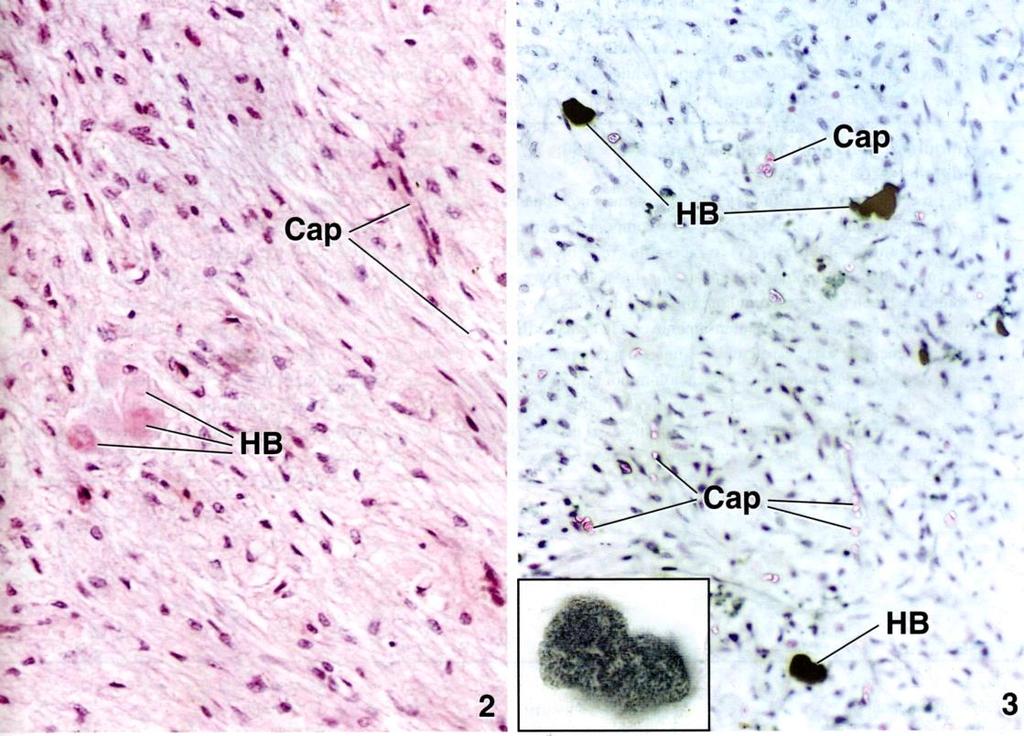 de neuronas de núcleos hipotálamo vesículas de neurosecreción (cuerpos