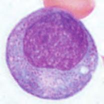 9 Linfocitos atípicos Monocitosis Gran. Inmad.? Desv. Izda.? Linfocitos atípicos? Anisocitosis Anemia Trombocitopenia Granulocitos inmaduros Parámetros de investigación IG 3.