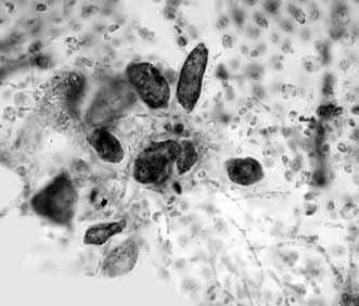 Blastophysa rhizopus, conjunto de células vesiculares sobre elhospedero. c. Onslowia bahamensis, nótesela base de los filamentos uni o biseriados. d. Onslowia bahamensis, detalle del propágulo.
