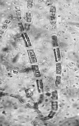 3c, d) Padina antillarum, Blastophysa rhizopus (Fig.
