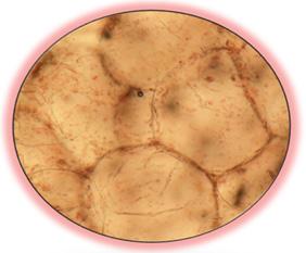 Fotografía de Cromoplasto de Jitomate (Lycopersicum esculentum), tomada con microscopio óptico binocular Carl Zeiss, objetivo 10x. Diciembre de 2011. Observación de amiloplastos 1.