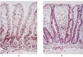En los vertebrados, las paredes intestinales están ampliamente plegadas, cada pliegue individual ofrece numerosas proyecciones denominadas vellosidades.