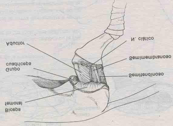 4-. Por reflexión del músculo bíceps femoral hacia proximal se descubre el nervio ciático, que se puede seguir hasta el nivel