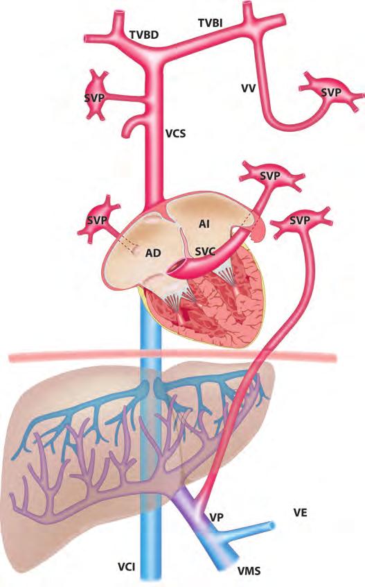 tanto, parte de las venas pulmonares o todas ellas conectan con el atrio derecho, ya sea directamente o a través de sus sistemas venosos tributarios.