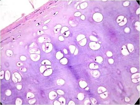 Los condrocitos envejecen hacia el centro del cartílago Técnica: Verhoeff's/Picro-Ponceau