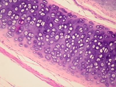 Tejido cartilaginoso hialino Localización: anillos traqueales, cartílagos costales, embriones de