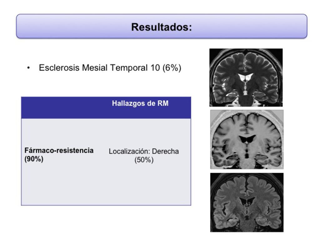 Fig. 8: Pacientes con epilepsia focal