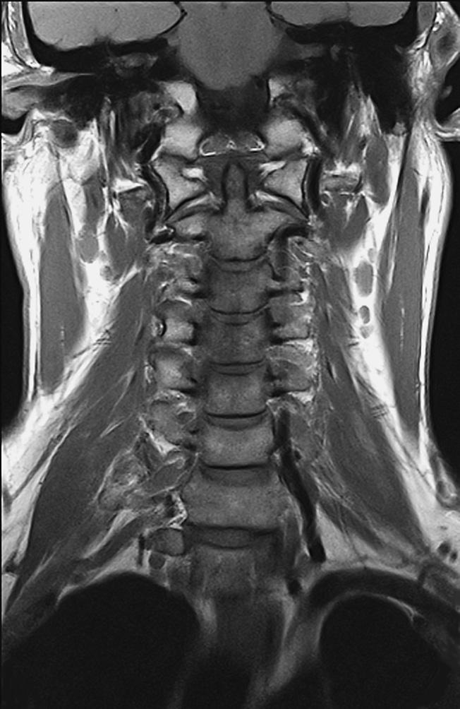 272 Columna vertebral Craneal Derecha Izquierda Caudal Conducto auditivo externo 2 Foramen