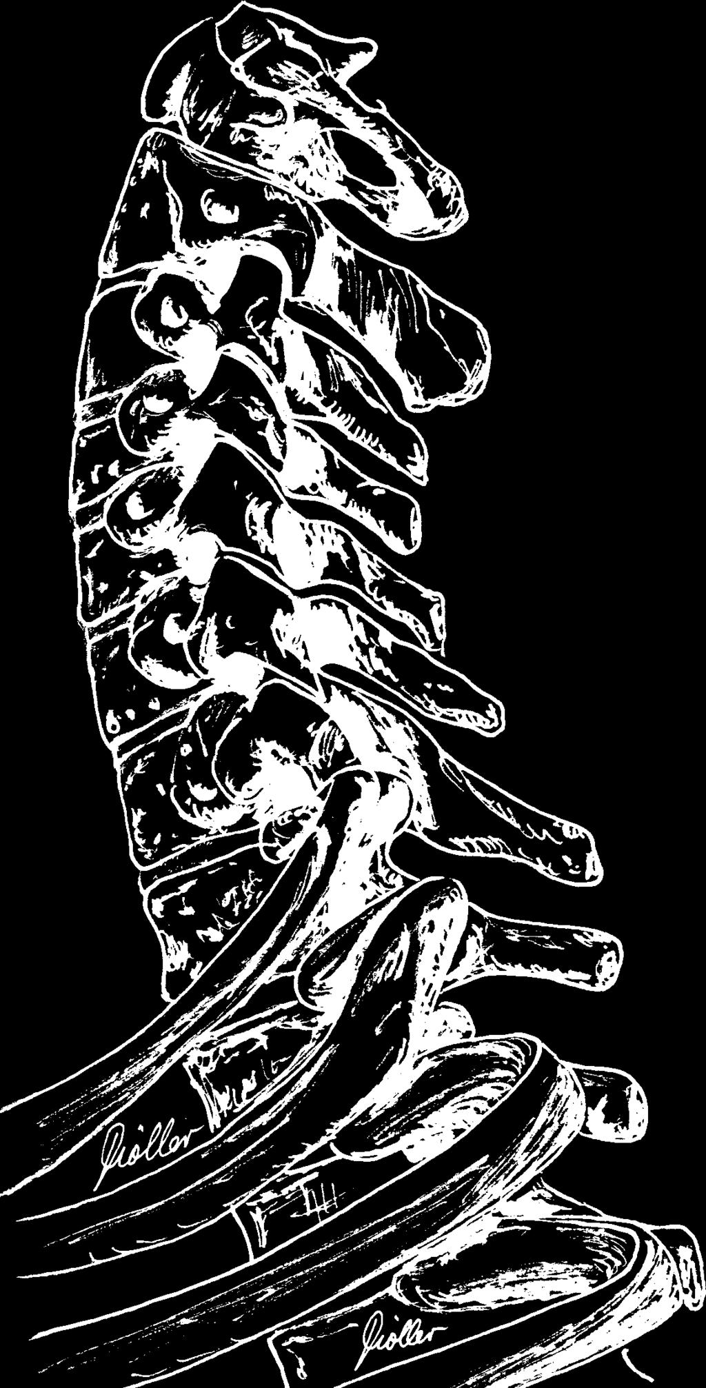 mastoides 4 Foramen magno Arteria vertebral 6 Músculo