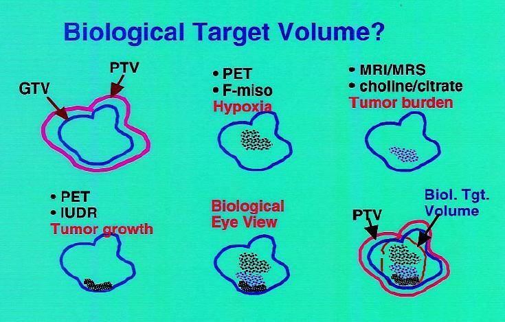 El Biolumen Tumor Hacia un modelo biológico y dinámico La localización n con técnicas t bioquímicas in vivo e imagen funcional (PET-MRSI) permitirá una definición n más m biológica de los volúmenes