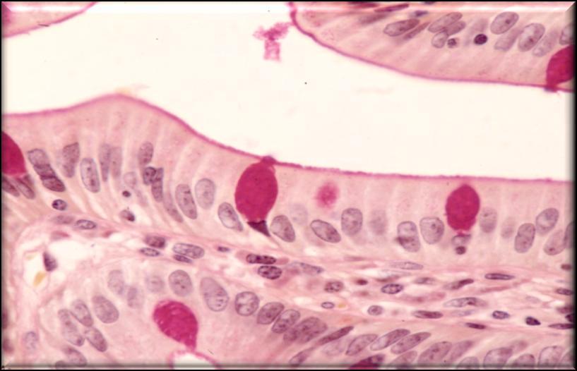 Caliciformes -> Mucus Células agrupadas Por su estructura