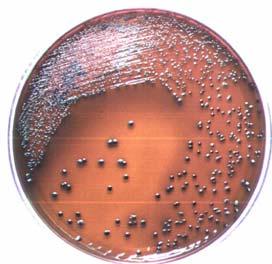 Muestras clínicas Medios de cultivo Sólido Líquido El objetivo de este paso es obtener colonias bacterianas aisladas.