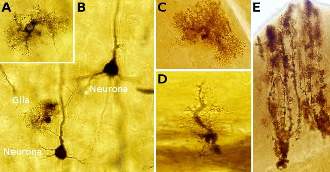 Tejidos animales. Nervioso. 7 El número, tamaño y disposición de las dendritas que posee una neurona es muy variable, mientras que cada neurona posee un solo axón (salvo excepciones).