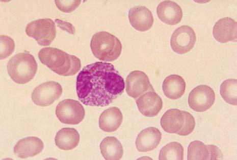 Epidermis de ceba Epiteli bucal Sang humana Totes les cèl lules són iguals? Tots els éssers vius estem formats per cèl lules.