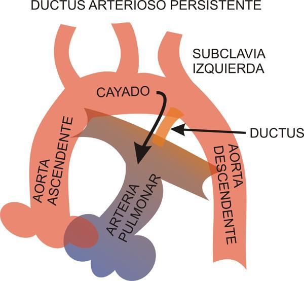 comunicación entre la aorta y al