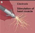 la misma manera que lleva el impulso eléctrico al corazón puede observar si el corazón esta latiendo espontáneamente o