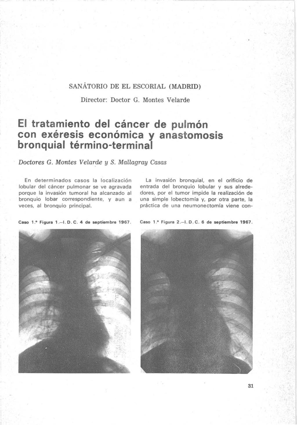 SANÁTORIO DE EL ESCORIAL (MADRID) Director: Doctor G. Montes Velarde El tratamiento del cáncer de pulmón con exéresis económica y anastomosis bronquial término-terminal Doctores G. Montes Velar.de y S.