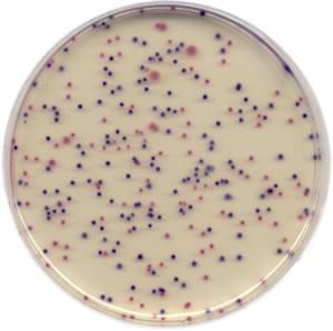 MÉTODO ALTERNATIVO RESULTADOS Bacterias coliformes (no E.
