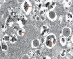 Micrografía de páncreas, células β (1), gránulos de secreción (2), células acinares (3)