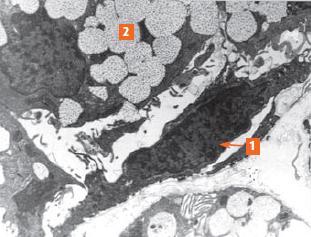 inmunohistoquímico para filamentos de actina (1), acinos mucosos (2),
