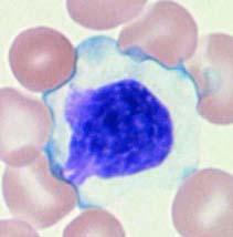 Información obtenida por el método de citometría de flujo Datos (sangre periférica) Células T Células B Moléculas de adhesión