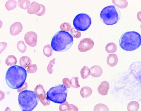 Información obtenida por el método de citometría de flujo Datos (sangre periférica) Células T Células B Granulocitos/ Monocitos Moléculas de adhesión celular CD2 5.6 CD10 94.5 CD13 56.3 CD11a 81.